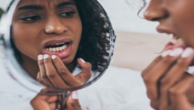 Rüyada Dişlerin Düştüğünü Görmek :  Uzmanlara Göre 7 Olası Anlam